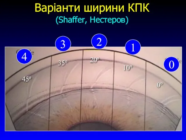 Варіанти ширини КПК (Shaffer, Нестеров) 4 3 2 1 0 45о 35о 20о 10о 0о