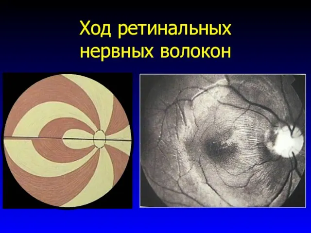 Ход ретинальных нервных волокон