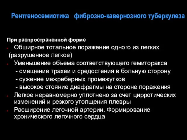 Рентгеносемиотика фиброзно-кавернозного туберкулеза При распространенной форме Обширное тотальное поражение одного из легких