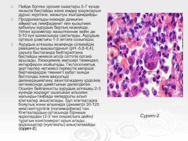 Пайда болған эрозия ошақтары 5-7 күнде жазыла бастайды және емдеу шараларын дұрыс