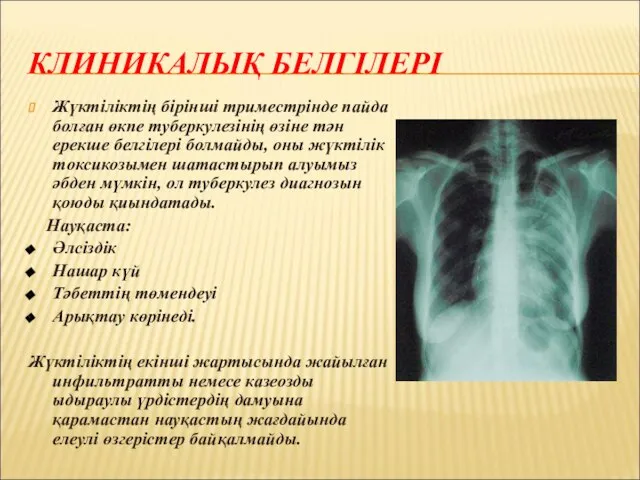 КЛИНИКАЛЫҚ БЕЛГІЛЕРІ Жүктіліктің бірінші триместрінде пайда болған өкпе туберкулезінің өзіне тән ерекше