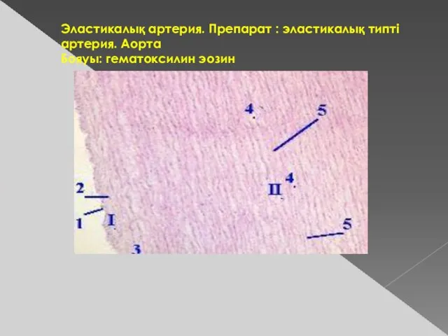 Эластикалық артерия. Препарат : эластикалық типті артерия. Аорта Бояуы: гематоксилин эозин