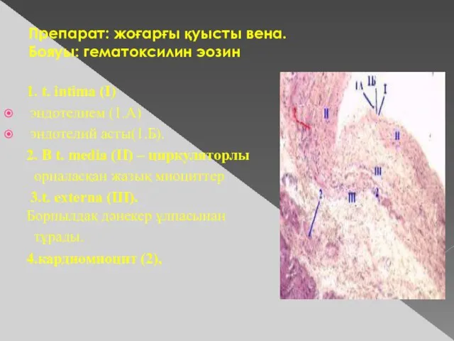 Препарат: жоғарғы қуысты вена. Бояуы: гематоксилин эозин 1. t. intima (I) эндотелием