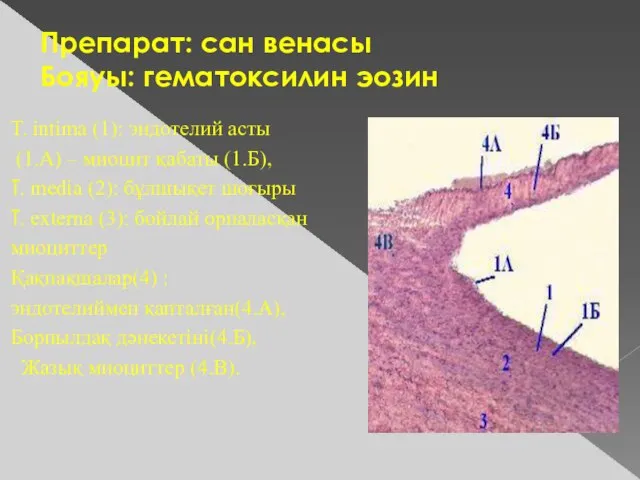 Препарат: сан венасы Бояуы: гематоксилин эозин T. intima (1): эндотелий асты (1.А)