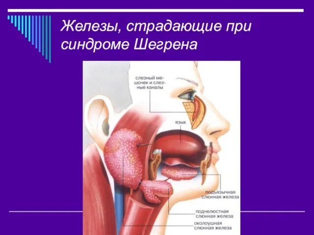 Железы, страдающие при синдроме Шегрена