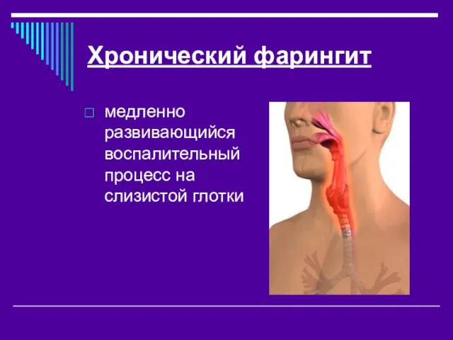 Хронический фарингит медленно развивающийся воспалительный процесс на слизистой глотки