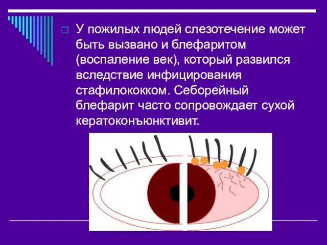 У пожилых людей слезотечение может быть вызвано и блефаритом (воспаление век), который