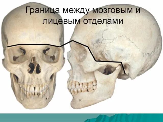 Граница между мозговым и лицевым отделами