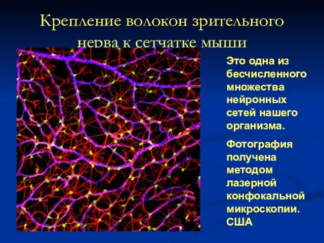 Крепление волокон зрительного нерва к сетчатке мыши Это одна из бесчисленного множества