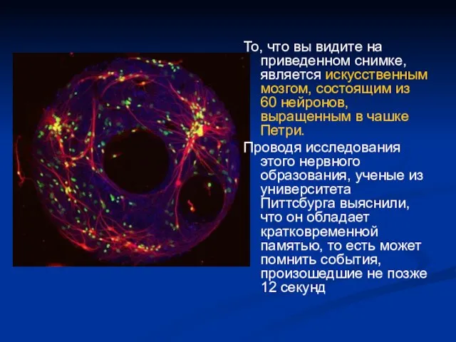 То, что вы видите на приведенном снимке, является искусственным мозгом, состоящим из