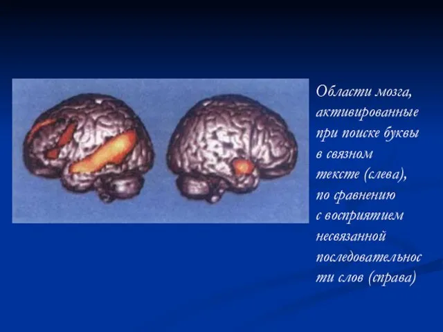 Области мозга, активированные при поиске буквы в связном тексте (слева), по сравнению