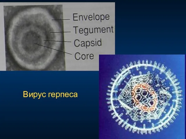 Вирус герпеса