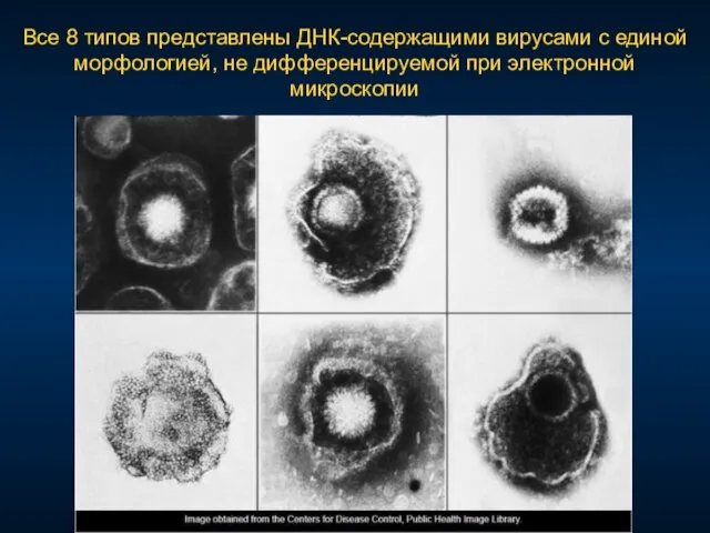 Все 8 типов представлены ДНК-содержащими вирусами с единой морфологией, не дифференцируемой при электронной микроскопии