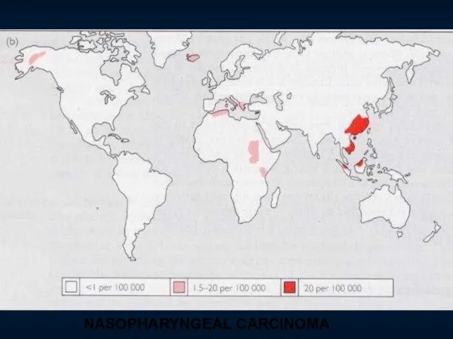 NASOPHARYNGEAL CARCINOMA