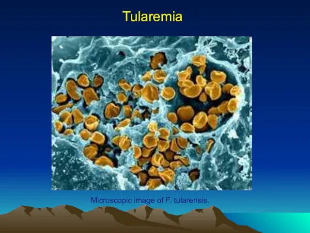 Tularemia Microscopic image of F. tularensis.