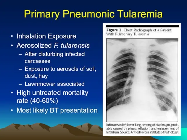 Primary Pneumonic Tularemia Inhalation Exposure Aerosolized F. tularensis After disturbing infected carcasses