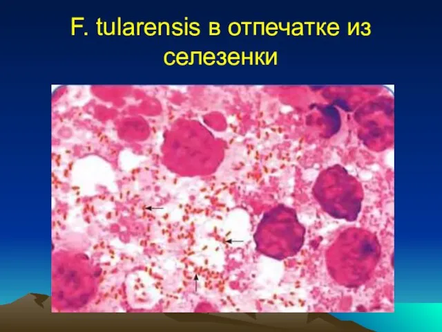 F. tularensis в отпечатке из селезенки