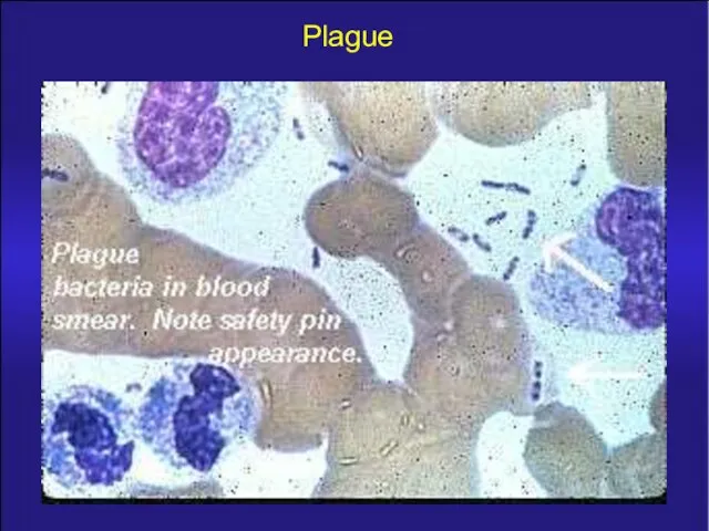 Plague