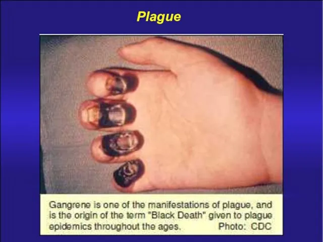 Plague