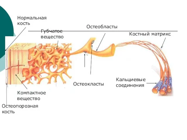 Кальциевые соединения Костный матрикс Остеокласты Остеобласты Нормальная кость Остеопорозная кость Компактное вещество Губчатое вещество