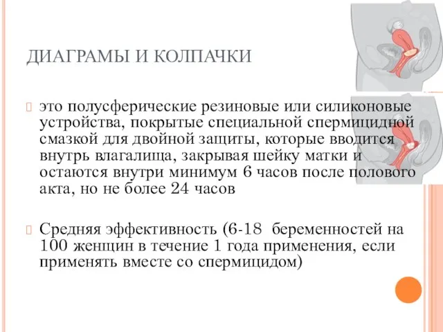 ДИАГРАМЫ И КОЛПАЧКИ это полусферические резиновые или силиконовые устройства, покрытые специальной спермицидной