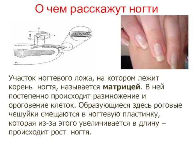 О чем расскажут ногти Участок ногтевого ложа, на котором лежит корень ногтя,