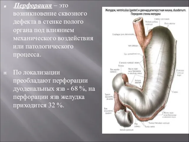 Перфорация – это возникновение сквозного дефекта в стенке полого органа под влиянием