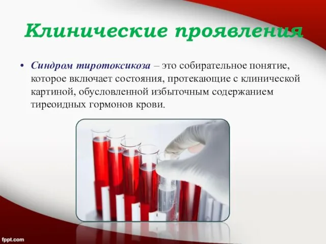 Клинические проявления Синдром тиротоксикоза – это собирательное понятие, которое включает состояния, протекающие