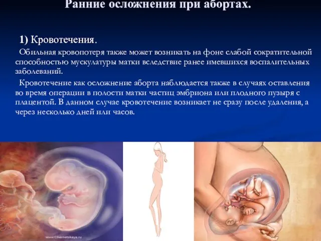 Ранние осложнения при абортах. 1) Кровотечения. Обильная кровопотеря также может возникать на