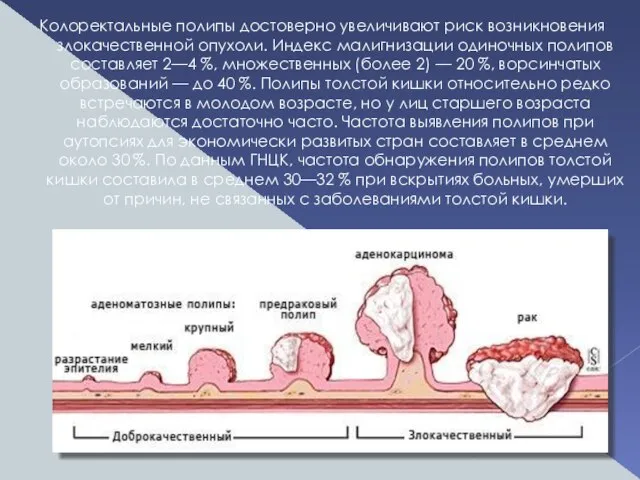 Колоректальные полипы достоверно увеличивают риск возникновения злокачественной опухоли. Индекс малигнизации одиночных полипов