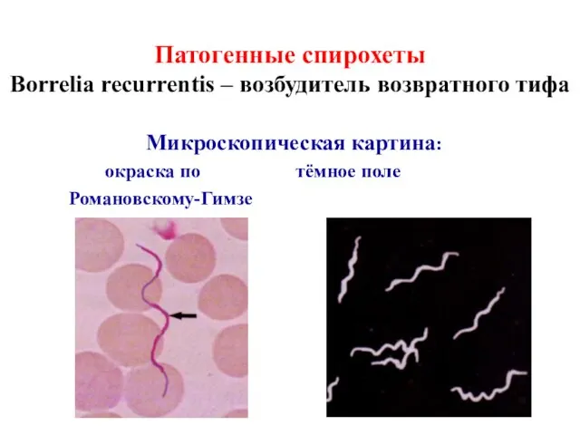 Патогенные спирохеты Borrelia recurrentis – возбудитель возвратного тифа Микроскопическая картина: окраска по тёмное поле Романовскому-Гимзе