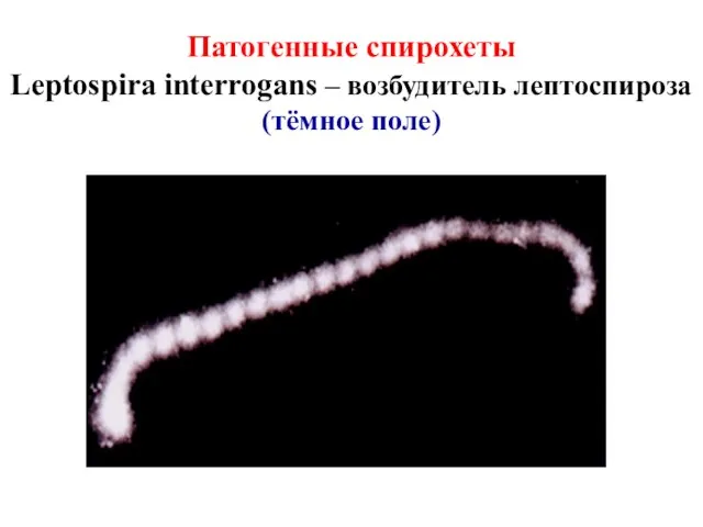 Патогенные спирохеты Leptospira interrogans – возбудитель лептоспироза (тёмное поле)