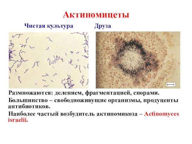 Актиномицеты Чистая культура Друза Размножаются: делением, фрагментацией, спорами. Большинство – свободноживущие организмы,