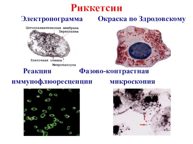 Риккетсии Электронограмма Окраска по Здродовскому Реакция Фазово-контрастная иммунофлюоресценции микроскопия