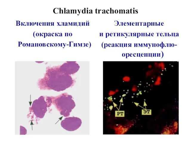 Chlamydia trachomatis Включения хламидий (окраска по Романовскому-Гимзе) Элементарные и ретикулярные тельца (реакция иммунофлю-оресценции)