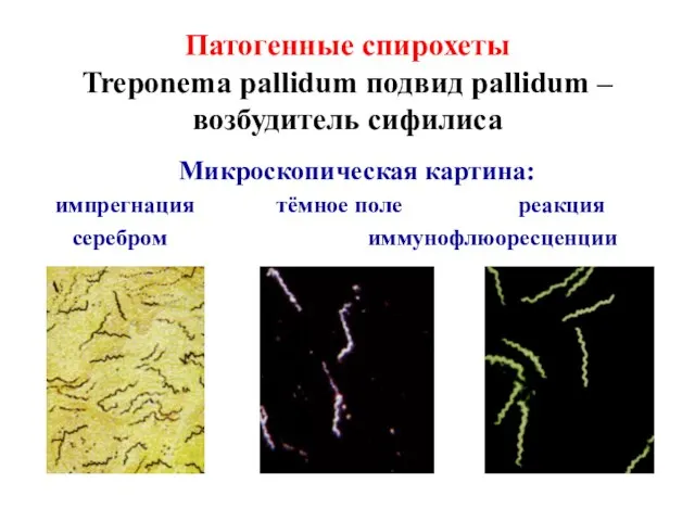 Патогенные спирохеты Treponema pallidum подвид pallidum – возбудитель сифилиса Микроскопическая картина: импрегнация