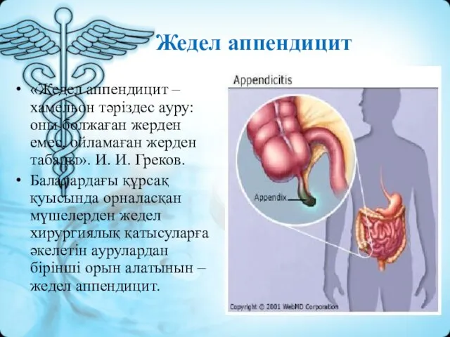 Жедел аппендицит «Жедел аппендицит – хамельон тәріздес ауру: оны болжаған жерден емес,