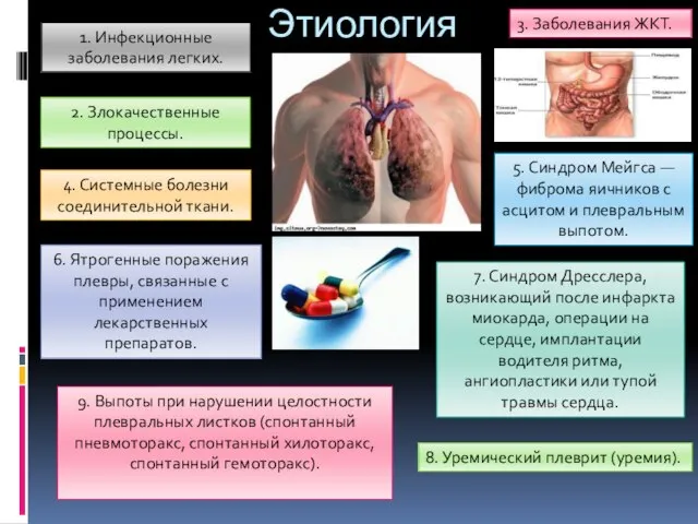 Этиология 1. Инфекционные заболевания легких. 2. Злокачественные процессы. 3. Заболевания ЖКТ. 4.