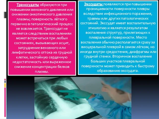 Транссудаты образуются при повышении венозного давления или снижении онкотического давления плазмы; поверхность