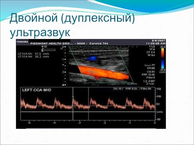 Двойной (дуплексный) ультразвук