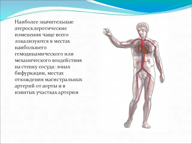 Наиболее значительные атеросклеротические изменения чаще всего локализуются в местах наибольшего гемодинамического или