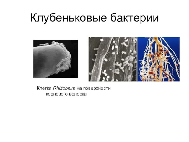 Клубеньковые бактерии Клетки Rhizobium на поверхности корневого волоска