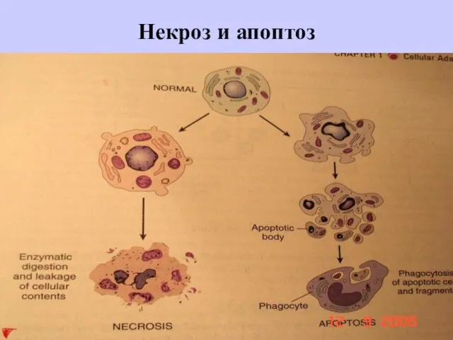 Некроз и апоптоз