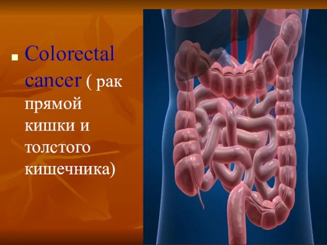 Colorectal cancer ( рак прямой кишки и толстого кишечника)