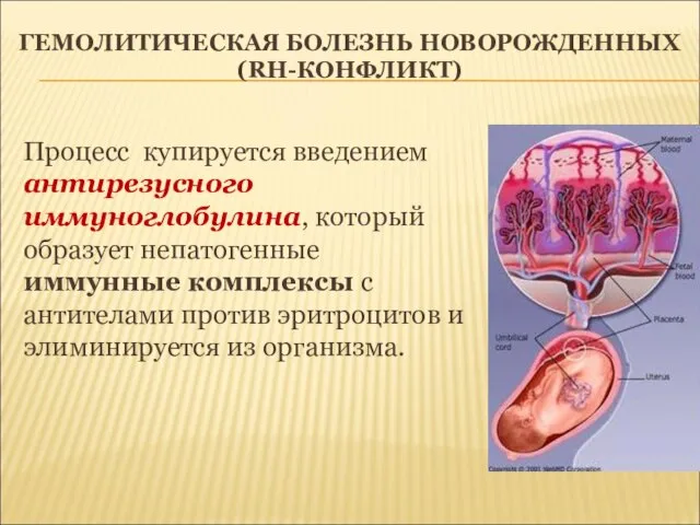 ГЕМОЛИТИЧЕСКАЯ БОЛЕЗНЬ НОВОРОЖДЕННЫХ (RH-КОНФЛИКТ) Процесс купируется введением антирезусного иммуноглобулина, который образует непатогенные