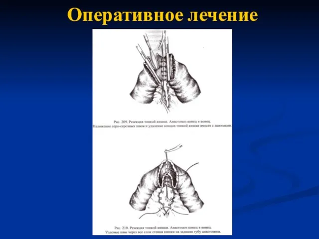 Оперативное лечение