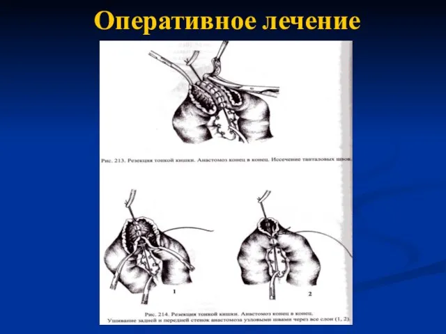 Оперативное лечение