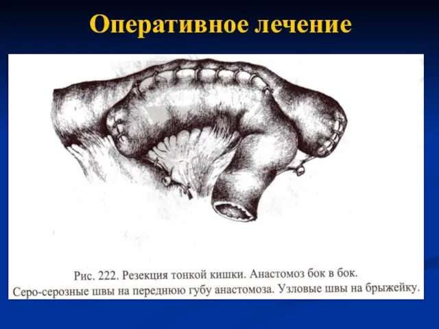 Оперативное лечение