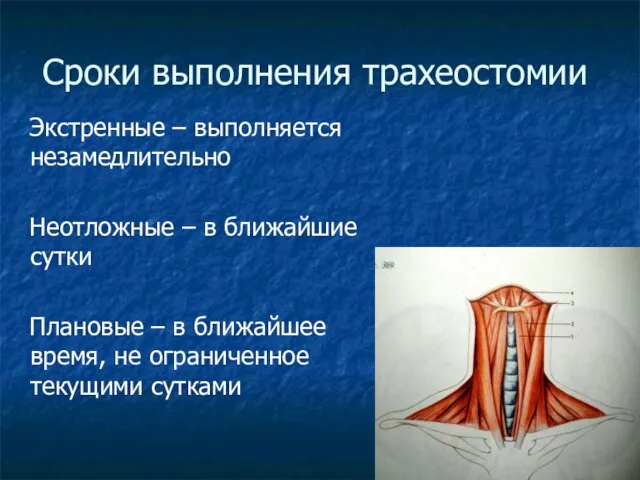 Сроки выполнения трахеостомии Экстренные – выполняется незамедлительно Неотложные – в ближайшие сутки