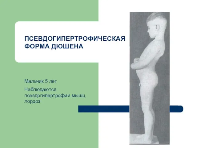 Мальчик 5 лет Наблюдаются псевдогипертрофии мышц, лордоз ПСЕВДОГИПЕРТРОФИЧЕСКАЯ ФОРМА ДЮШЕНА